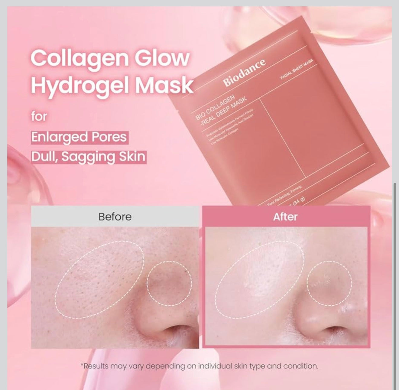BIODANCE Bio-Collagen Real Deep Hydrogel Mask – Box of 4